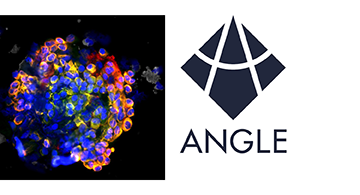 EMA25_ShrtRev_ANGLE.png